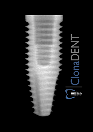 Neodent